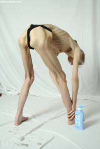 EXTREME Skinny Anorexic Janine 1-f7btsgxv4i.jpg