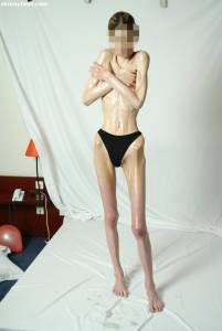 EXTREME Skinny Anorexic Janine 1 h7btshmkrs
