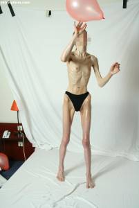 EXTREME-Skinny-Anorexic-Janine-1-n7btsicf5p.jpg