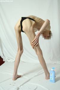 EXTREME Skinny Anorexic Janine 1 h7btshapop