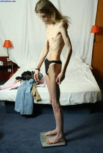 EXTREME Skinny Anorexic Janine 1 17btsbvnd3