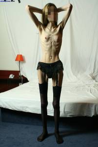 EXTREME Skinny Anorexic Janine 1-v7btsdf0zn.jpg