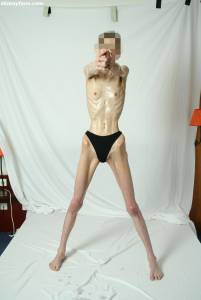 EXTREME Skinny Anorexic Janine 1 57btshvken