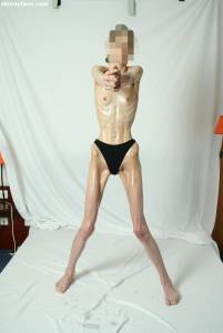 EXTREME Skinny Anorexic Janine 1 o7btshw0ew