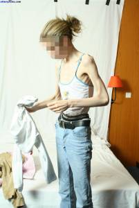 EXTREME Skinny Anorexic Janine 1 c7btsawteh