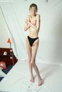 EXTREME Skinny Anorexic Janine 1-i7btshnu1a.jpg