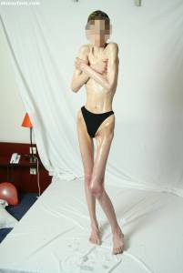 EXTREME Skinny Anorexic Janine 1 i7btshnu1a