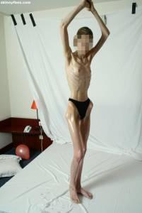 EXTREME Skinny Anorexic Janine 1 b7btsh0cgm