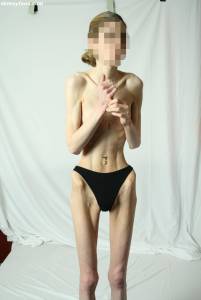 EXTREME Skinny Anorexic Janine 1-t7btsft4ul.jpg
