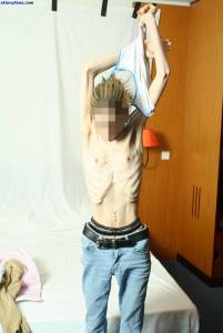 EXTREME Skinny Anorexic Janine 1 c7btsbdt0b