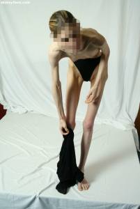EXTREME Skinny Anorexic Janine 1 p7btsfnnp0
