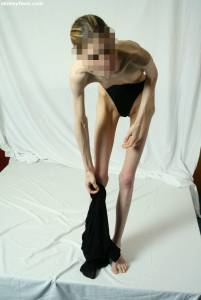 EXTREME Skinny Anorexic Janine 1-p7btsfnnp0.jpg