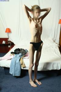 EXTREME Skinny Anorexic Janine 1 z7btsbn7jc