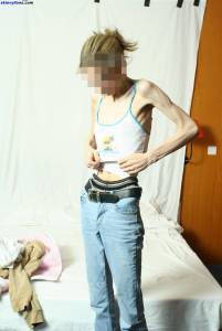 EXTREME Skinny Anorexic Janine 1 f7btsaxag1