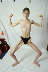 EXTREME Skinny Anorexic Janine 1 e7btsh2uzc