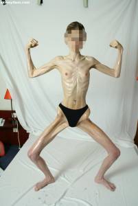 EXTREME Skinny Anorexic Janine 1-e7btsh2uzc.jpg