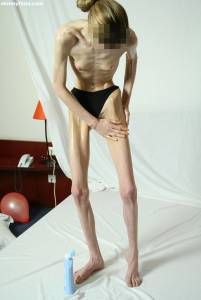 EXTREME Skinny Anorexic Janine 1 77btsgji6g