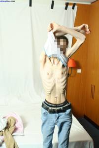 EXTREME Skinny Anorexic Janine 1 r7btsbcgnw