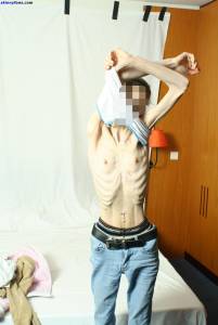 EXTREME Skinny Anorexic Janine 1-r7btsbcgnw.jpg