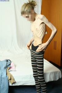 EXTREME Skinny Anorexic Janine 1 d7btsb1ty4