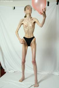 EXTREME Skinny Anorexic Janine 1 g7btsiksg6