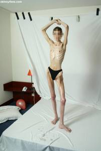 EXTREME Skinny Anorexic Janine 1 u7btsh13qc
