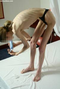 EXTREME Skinny Anorexic Janine 1 m7btsg5qlz