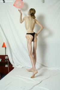 EXTREME Skinny Anorexic Janine 1-q7btsi9dvu.jpg