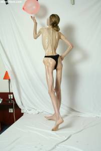 EXTREME Skinny Anorexic Janine 1 q7btsi9dvu