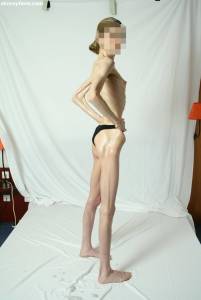 EXTREME Skinny Anorexic Janine 1 d7btsh87wx
