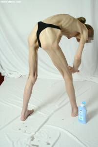 EXTREME Skinny Anorexic Janine 1 h7btshcwb4