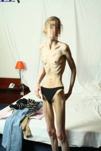 EXTREME Skinny Anorexic Janine 1 a7btsb9wn7