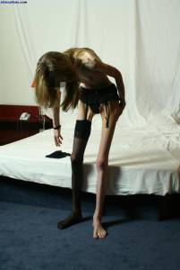 EXTREME-Skinny-Anorexic-Janine-1-k7btscucrf.jpg