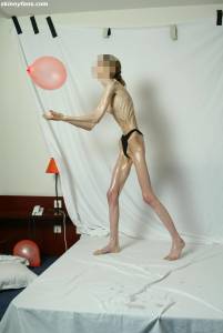 EXTREME Skinny Anorexic Janine 1 y7btsi45gx