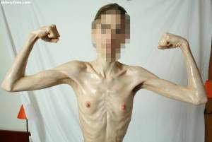 EXTREME Skinny Anorexic Janine 1 g7btsh55ud