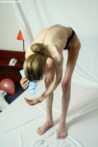EXTREME Skinny Anorexic Janine 1 b7btsg1hcy