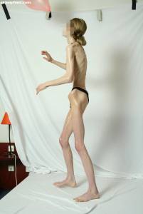 EXTREME Skinny Anorexic Janine 1 07btsi8vct