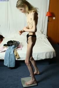 EXTREME Skinny Anorexic Janine 1 07btsbuhcx