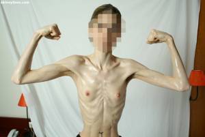 EXTREME Skinny Anorexic Janine 1 27btsh6s57