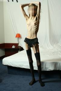 EXTREME Skinny Anorexic Janine 1 l7btsdhvqm