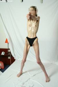 EXTREME Skinny Anorexic Janine 1 f7btsibfek