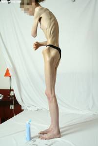 EXTREME Skinny Anorexic Janine 1 g7btsgnj0l