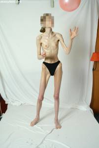 EXTREME Skinny Anorexic Janine 1 o7btsi2rba