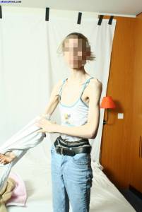 EXTREME Skinny Anorexic Janine 1 17btsaunxw