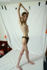 EXTREME Skinny Anorexic Janine 1 m7btshhsyj